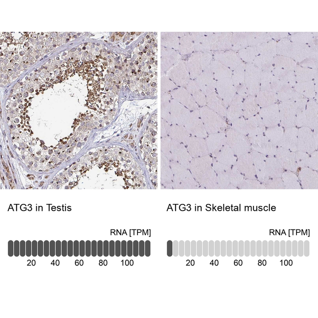ATG3 Antibody in Immunohistochemistry (Paraffin) (IHC (P))