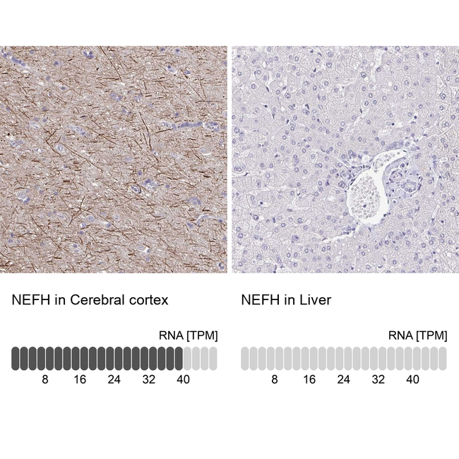 NF-H Antibody in Immunohistochemistry (Paraffin) (IHC (P))