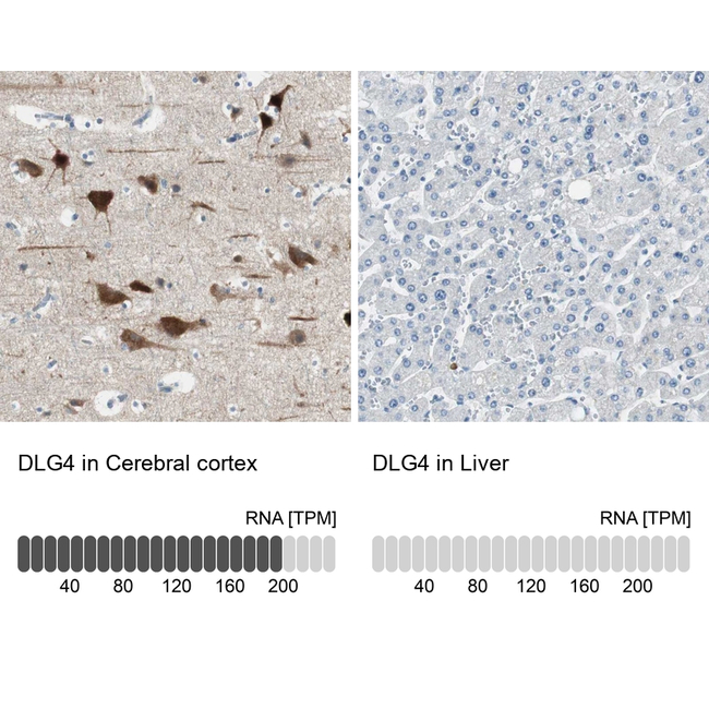 PSD-95 Antibody in Immunohistochemistry (Paraffin) (IHC (P))