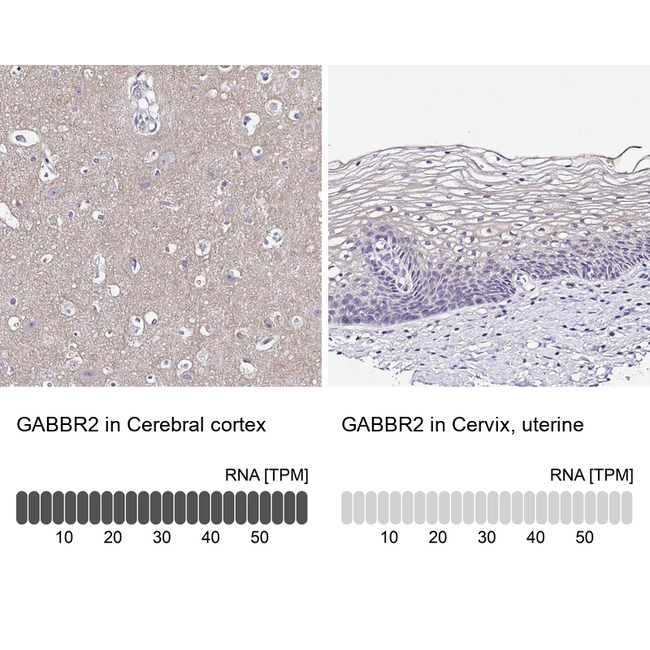 GABBR2 Antibody in Immunohistochemistry (Paraffin) (IHC (P))