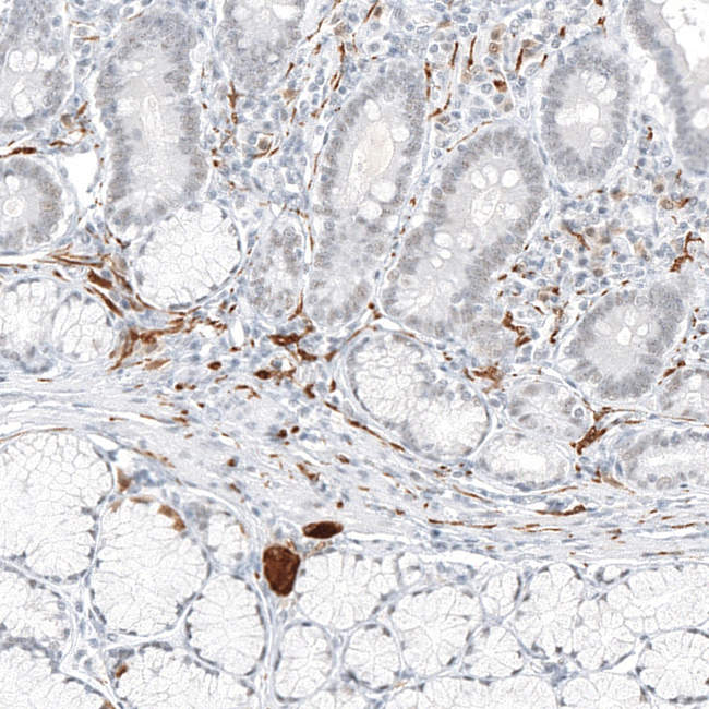 TrkA Antibody in Immunohistochemistry (Paraffin) (IHC (P))