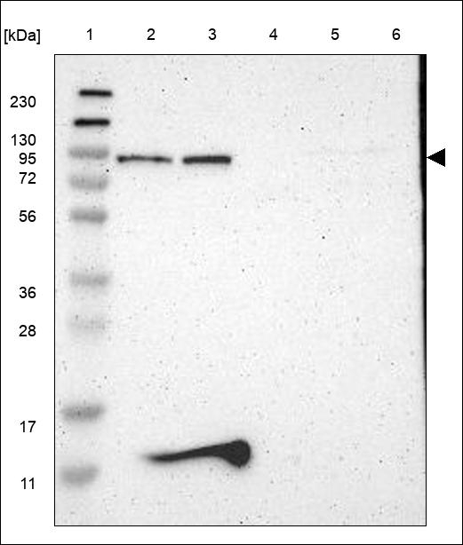 GALNT8 Antibody in Western Blot (WB)