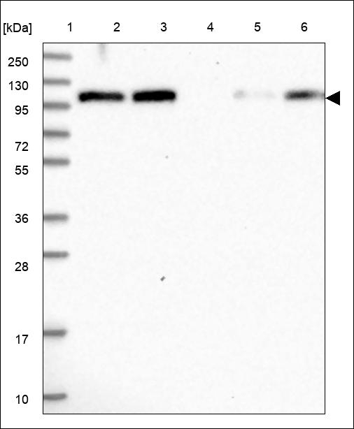 FAM160B1 Antibody in Western Blot (WB)