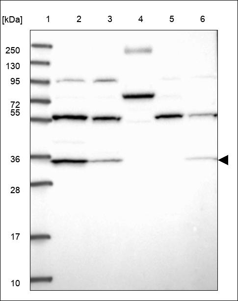 C20orf196 Antibody in Western Blot (WB)