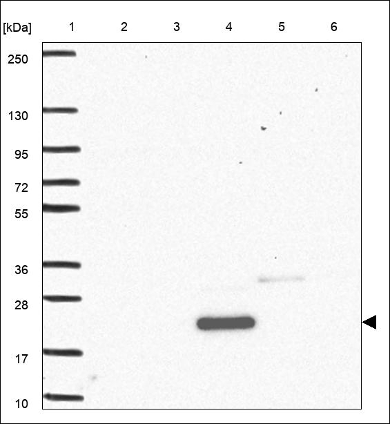 IRGM Antibody in Western Blot (WB)