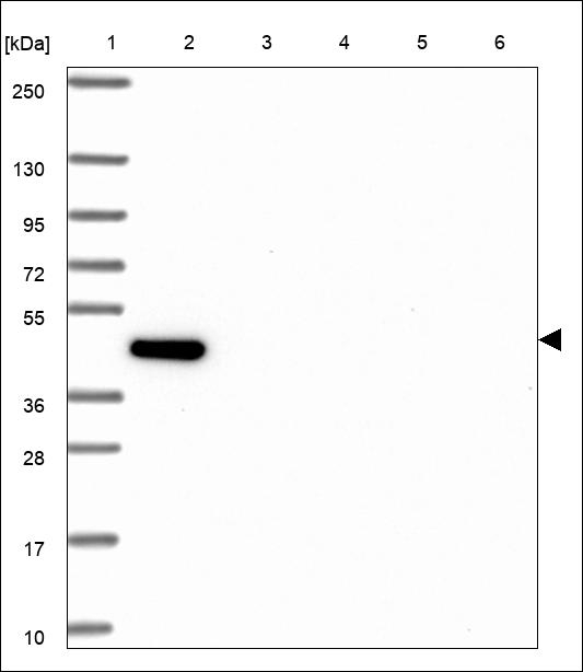 KIAA1609 Antibody in Western Blot (WB)