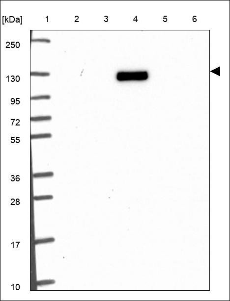 BTBD11 Antibody in Western Blot (WB)