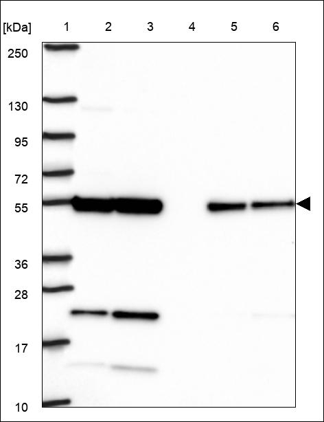 Septin-11 Antibody in Western Blot (WB)