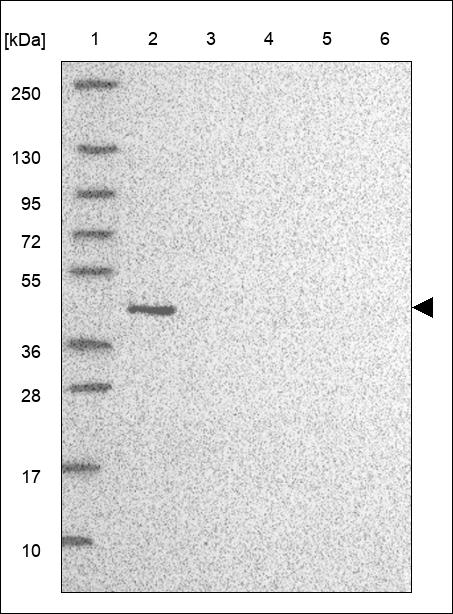 CBWD2 Antibody in Western Blot (WB)