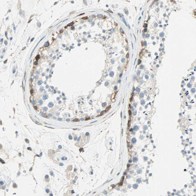 ATF6 Antibody in Immunohistochemistry (Paraffin) (IHC (P))