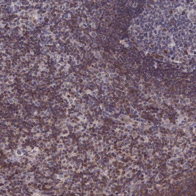 IL-7 Antibody in Immunohistochemistry (Paraffin) (IHC (P))