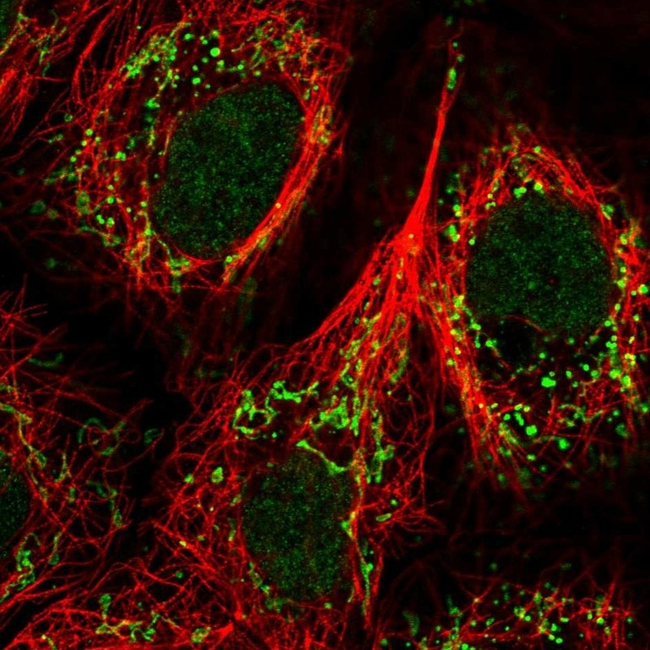 GPR87 Antibody in Immunocytochemistry (ICC/IF)