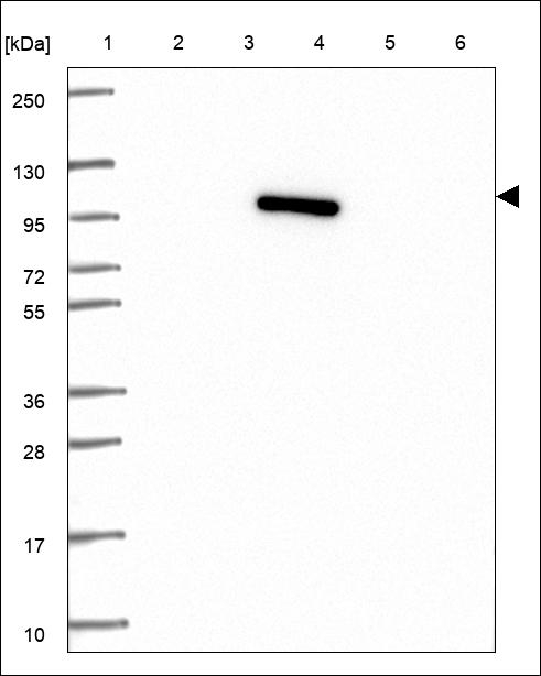 NUTM2A Antibody in Western Blot (WB)