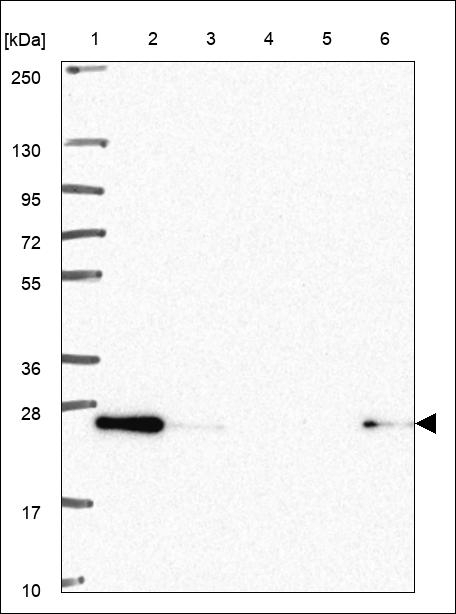 AES Antibody in Western Blot (WB)