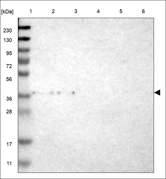 TAS2R8 Antibody in Western Blot (WB)
