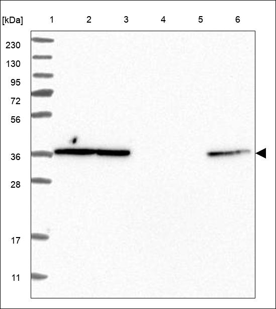 OR1B1 Antibody in Western Blot (WB)