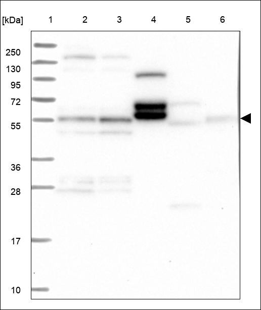 TADA2B Antibody in Western Blot (WB)