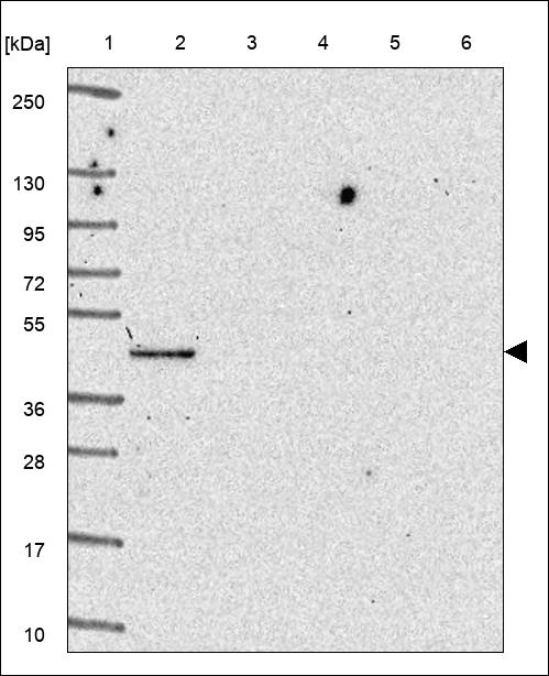 CYP4A11 Antibody in Western Blot (WB)