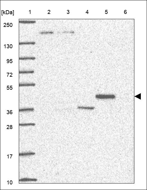 LPCAT3 Antibody in Western Blot (WB)