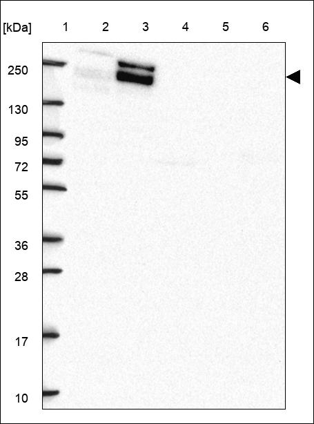 AIM1 Antibody in Western Blot (WB)