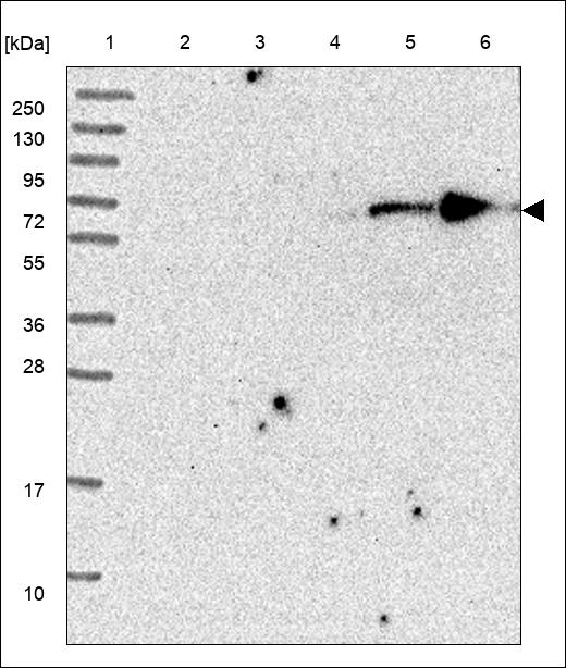 KLHL23 Antibody in Western Blot (WB)