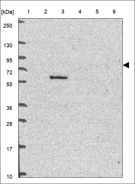 RHBDF1 Antibody in Western Blot (WB)