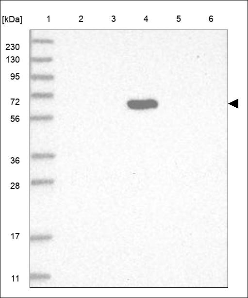 C8A Antibody in Western Blot (WB)