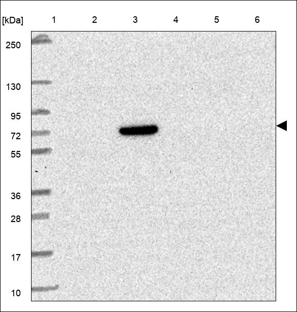 C8A Antibody in Western Blot (WB)