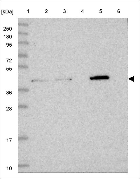 ZDHHC11 Antibody in Western Blot (WB)