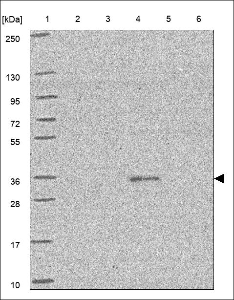 OR2Y1 Antibody in Western Blot (WB)