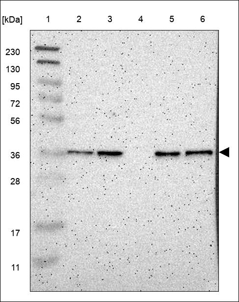 LDLRAD3 Antibody in Western Blot (WB)