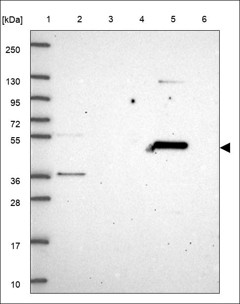 NPRL3 Antibody in Western Blot (WB)