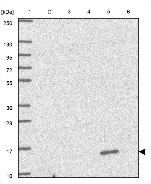 GOLT1A Antibody in Western Blot (WB)