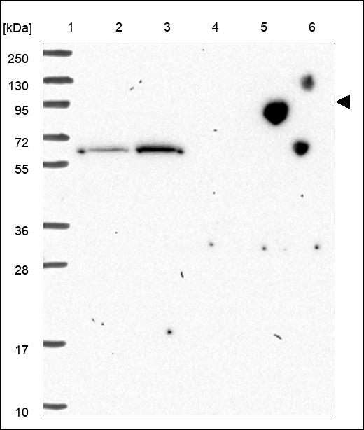 PTPN4 Antibody in Western Blot (WB)