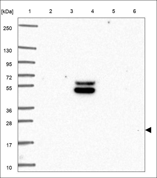 PACAP-38 Antibody in Western Blot (WB)