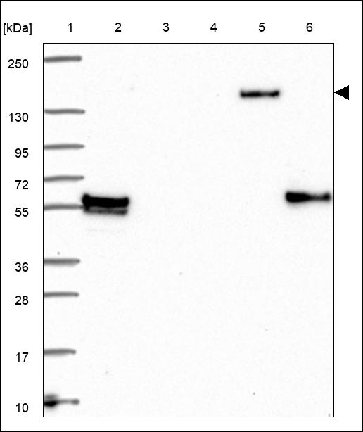 FBXL10 Antibody in Western Blot (WB)