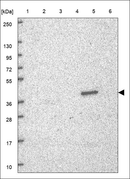 AKR7A3 Antibody in Western Blot (WB)