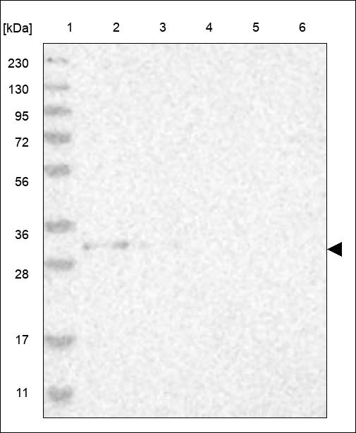 PSMC3IP Antibody in Western Blot (WB)
