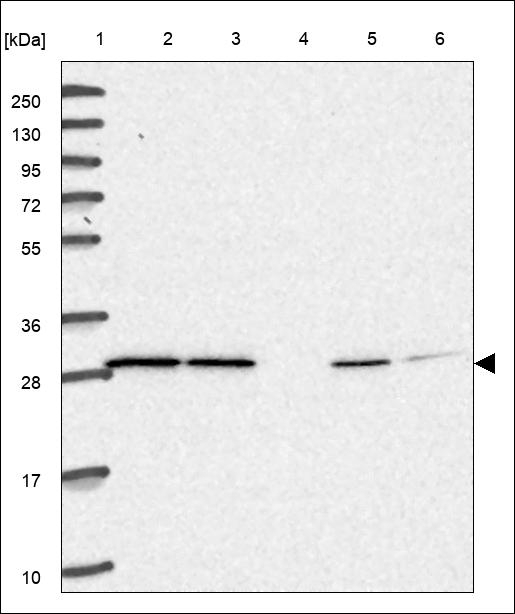 RAB15 Antibody in Western Blot (WB)