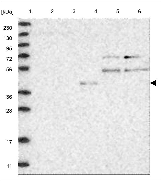 NeuroD6 Antibody in Western Blot (WB)