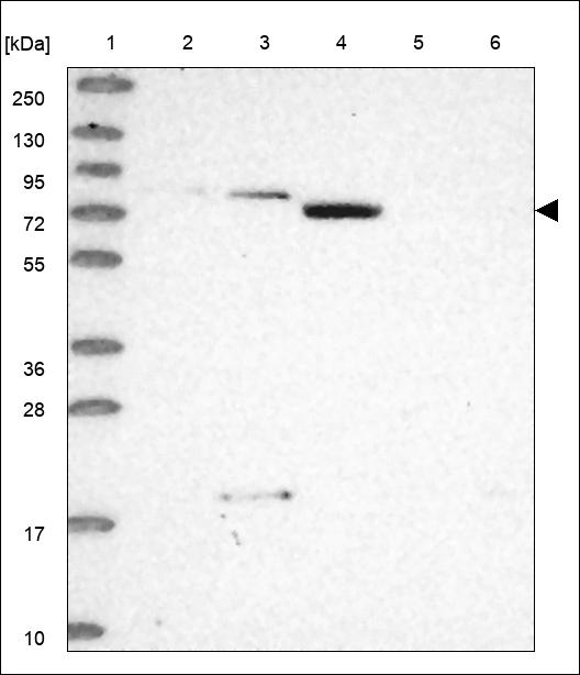 SLC26A5 Antibody in Western Blot (WB)