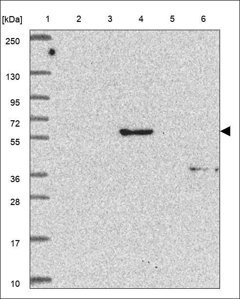 ARL13B Antibody in Western Blot (WB)
