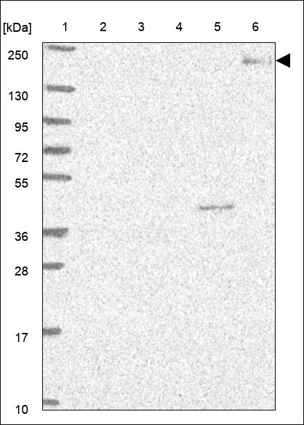 LTBP4 Antibody in Western Blot (WB)