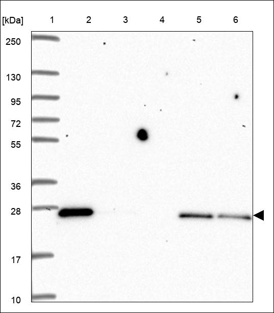 LYPLA2 Antibody in Western Blot (WB)