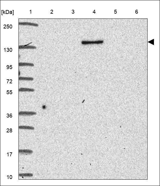 SLC9A10 Antibody in Western Blot (WB)