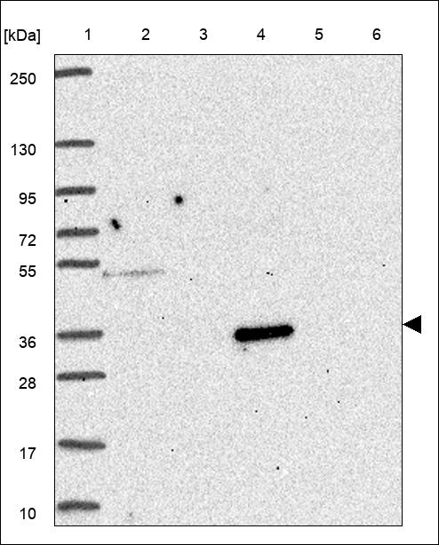 SERPINB12 Antibody in Western Blot (WB)