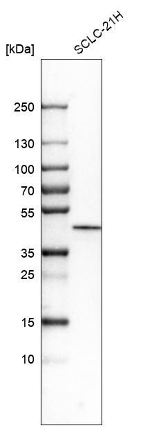 CK1 epsilon Antibody in Western Blot (WB)