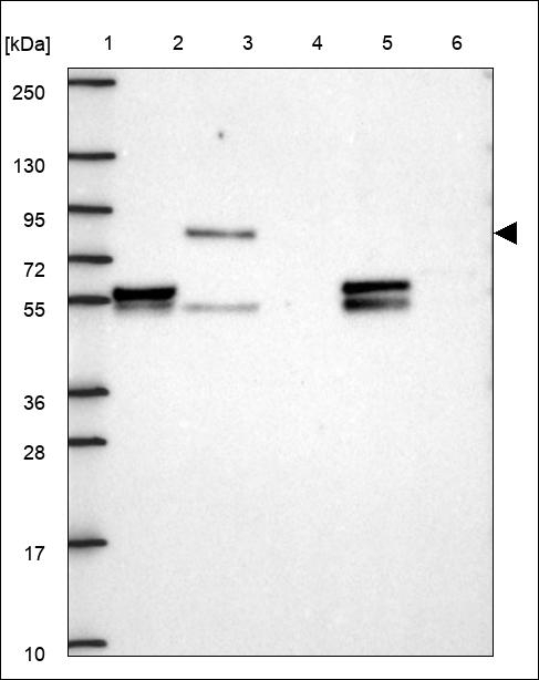 POMT1 Antibody in Western Blot (WB)