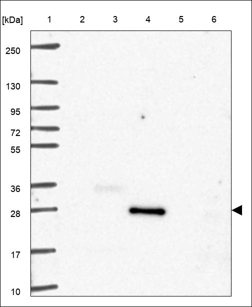 CRLS1 Antibody in Western Blot (WB)