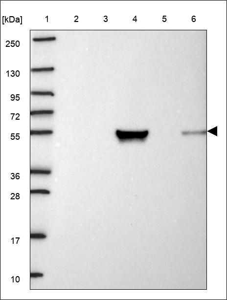 CYP8B1 Antibody in Western Blot (WB)